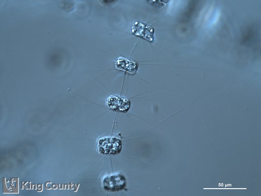 Photo of Thalassiosira pacifica/Thalassiosira aestivalis